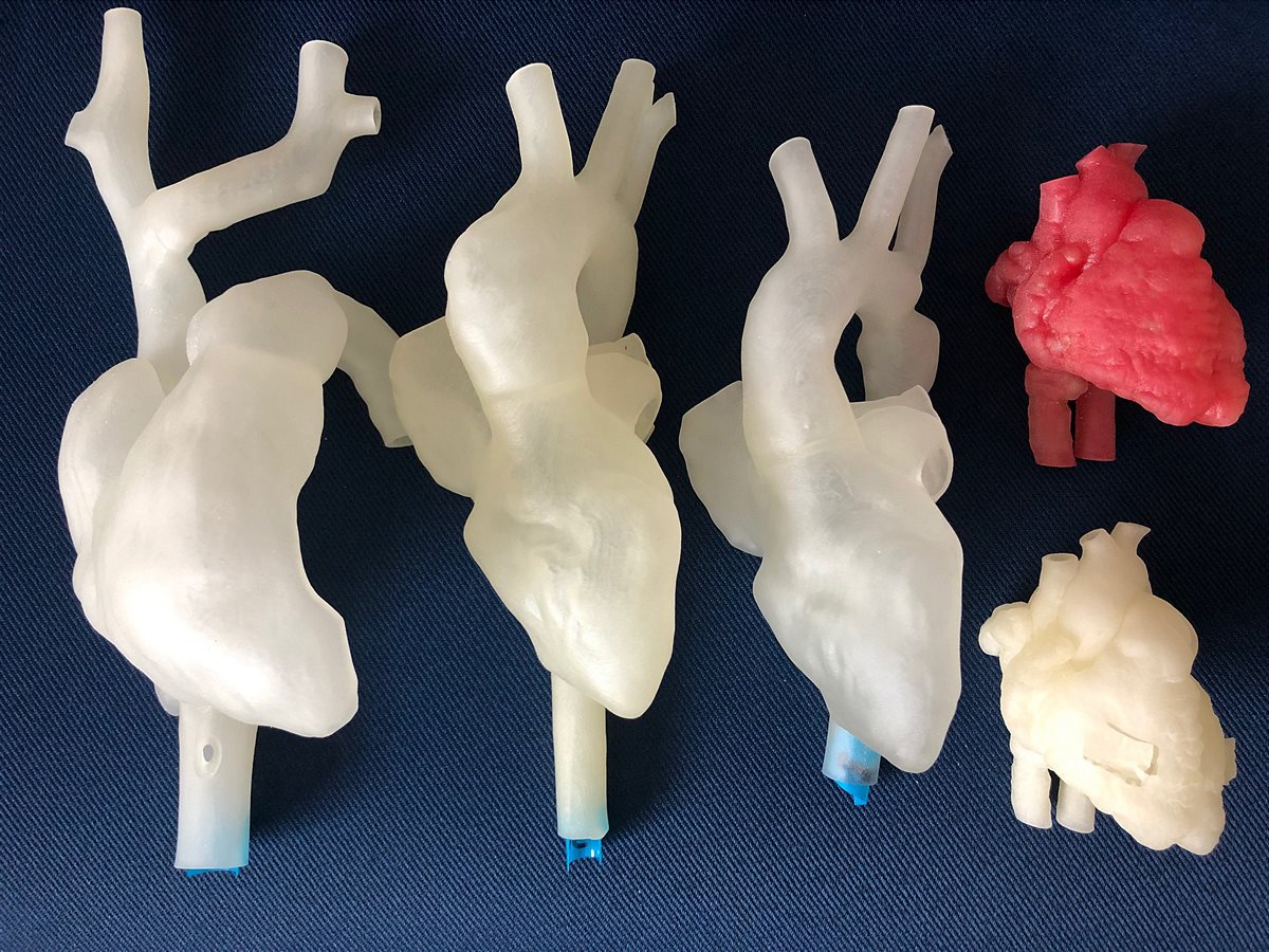 LMU Klinikum - 3D-gedruckte Herzmodelle